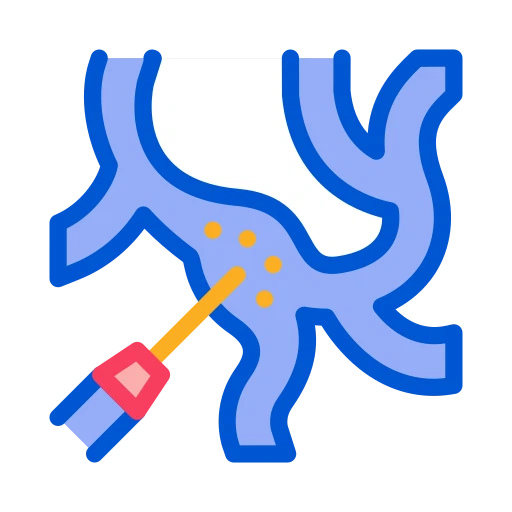 Interventional Vascular Surgery